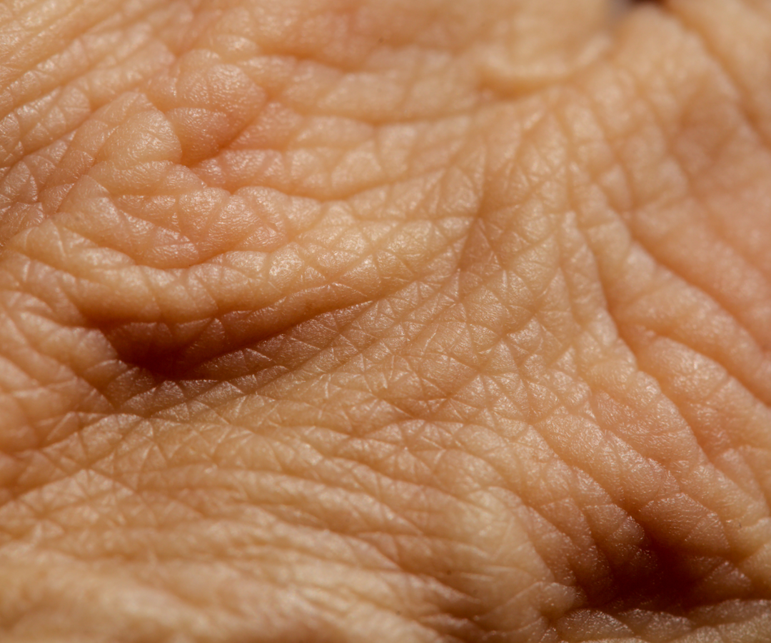 Skin Barrier Basics: Strengthening Your Skin's Natural Defences